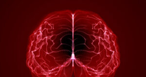 Parkinsons