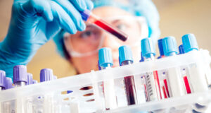 Scandion AML Q1 2023