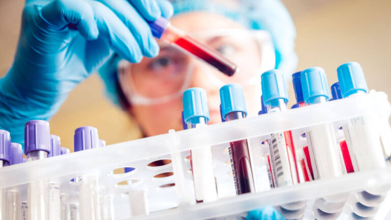 Scandion AML Q1 2023