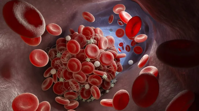 Aplagon tar in 7 miljoner euro