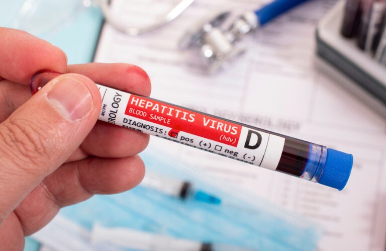 Hepatit D Test