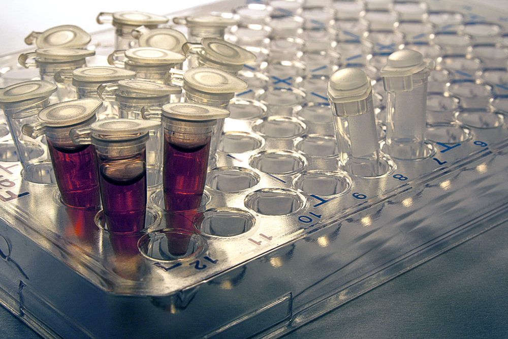Steamcell Lab Breakthrough in large-scale stem cell production in Uppsala - Biostock