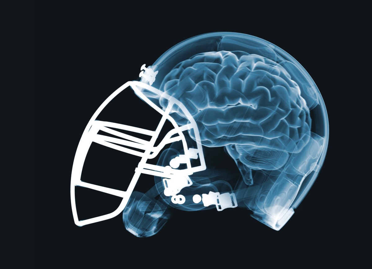 sportsconcussion