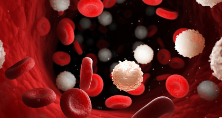 WntResearchs drug candidate shows potential in leukemia