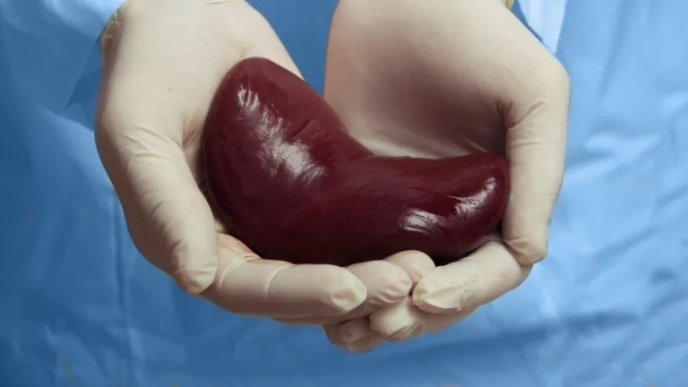 Kidney transplanted